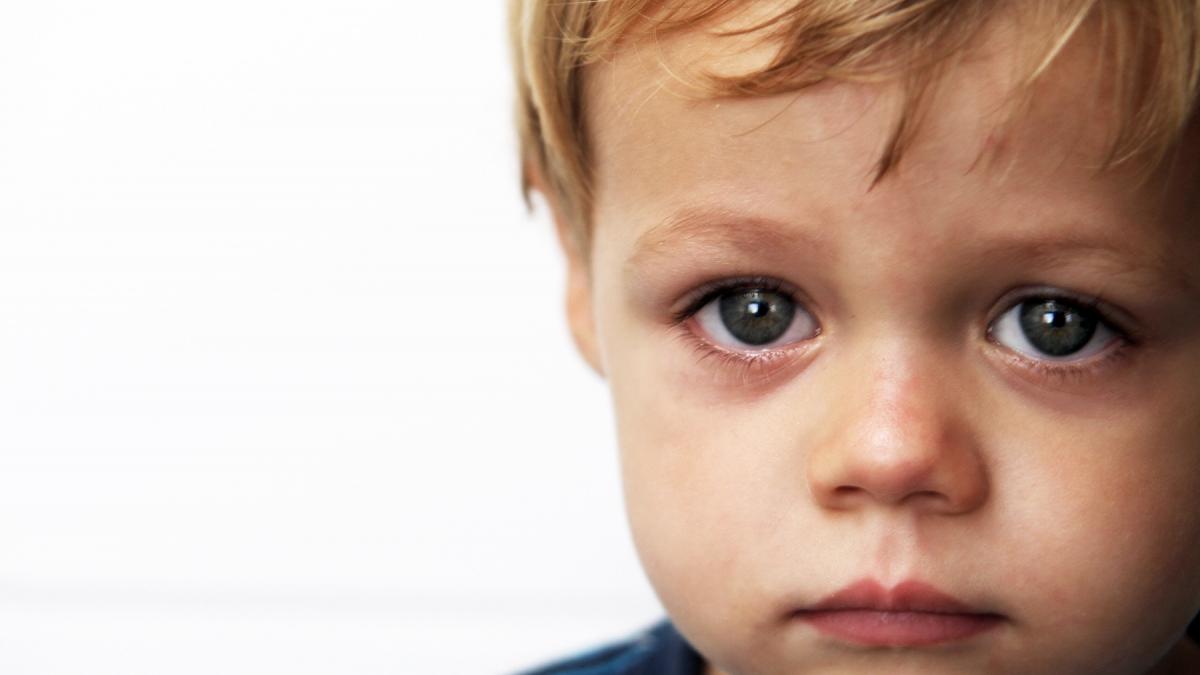 afectiunea rara care ii impiedica pe oameni sa zambeasca