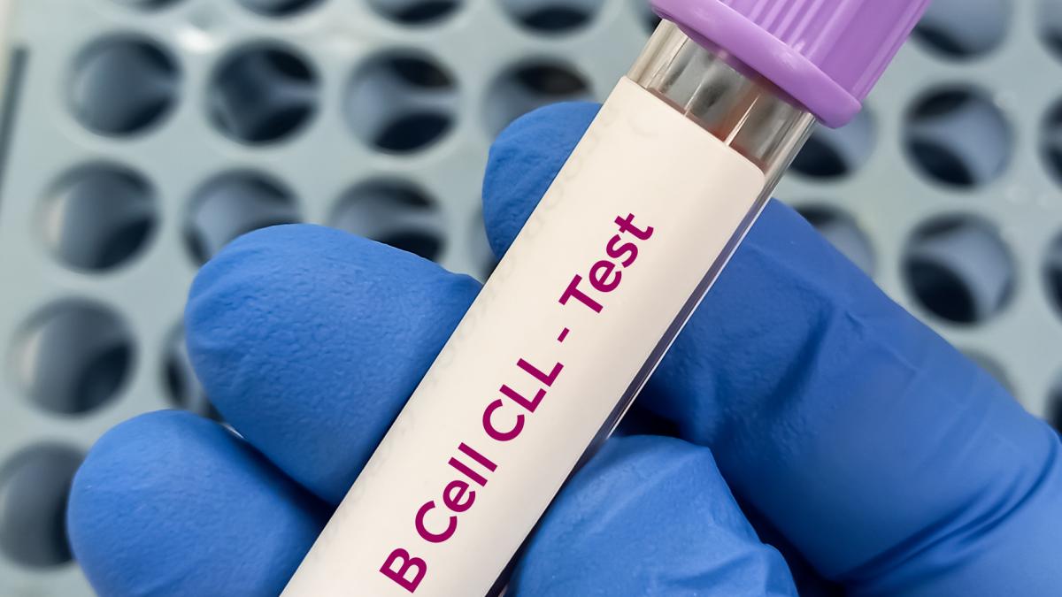 succes in tratamentul pentru leucemie doua medicamente au fost mai eficiente decat chimioterapia si au oprit evolutia bolii