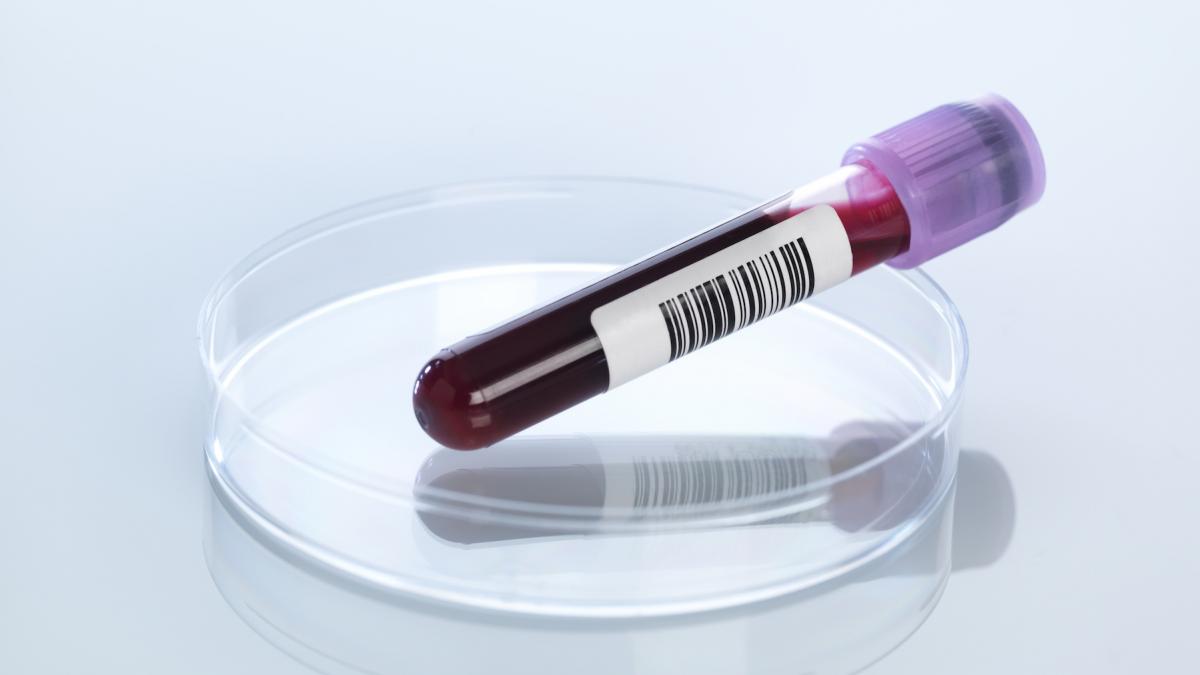 testul de sange revolutionar care detecteaza cancerul cu multi ani inainte de aparitia simptomelor