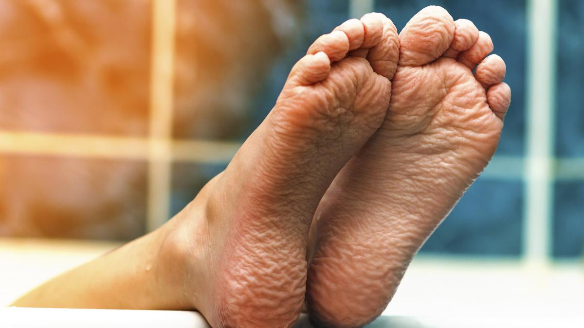 de ce ni se increteste pielea de pe degete cand stam in apa si ce spune asta despre sanatatea noastra