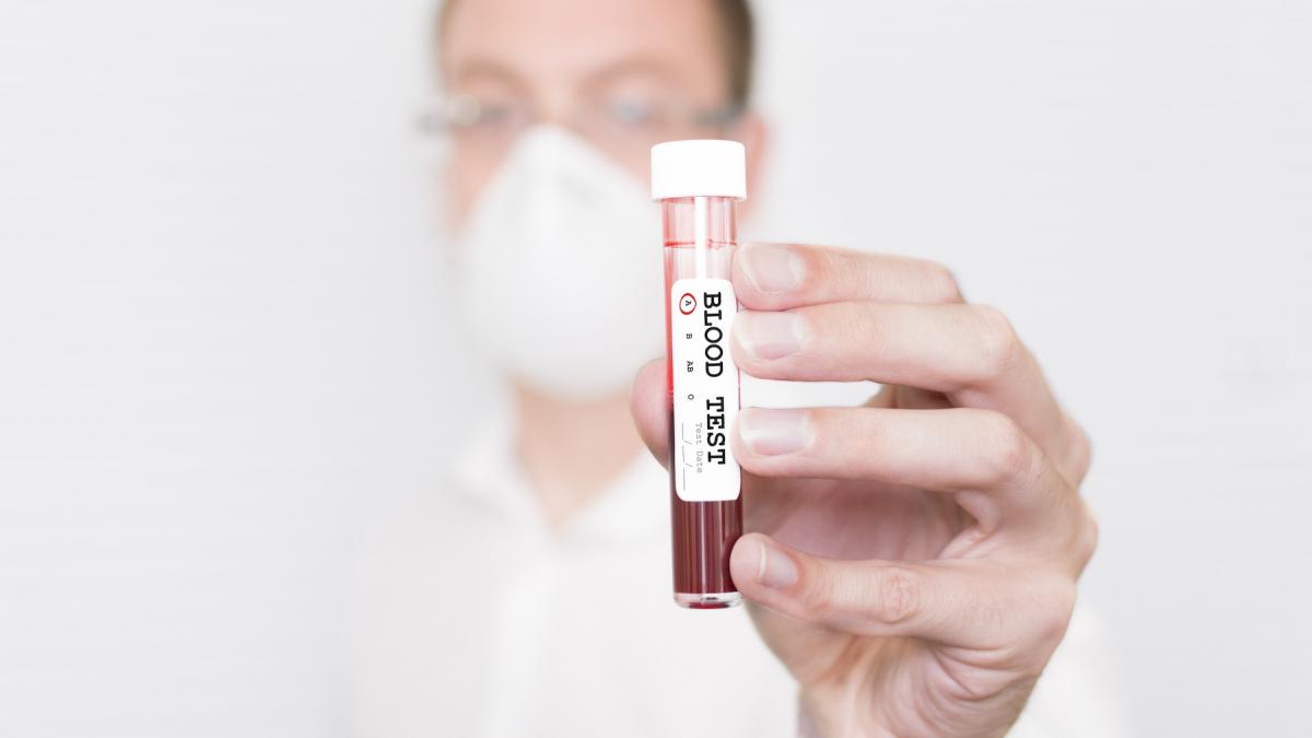 medic ce tine in mana o eprubeta cu sange