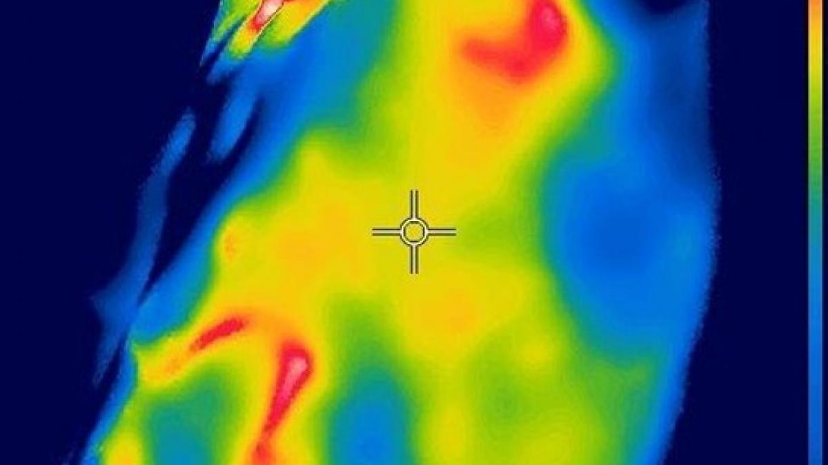 ce se intampla in corpul tau chiar inainte sa simti ceva termografia mamara poate raspunde p