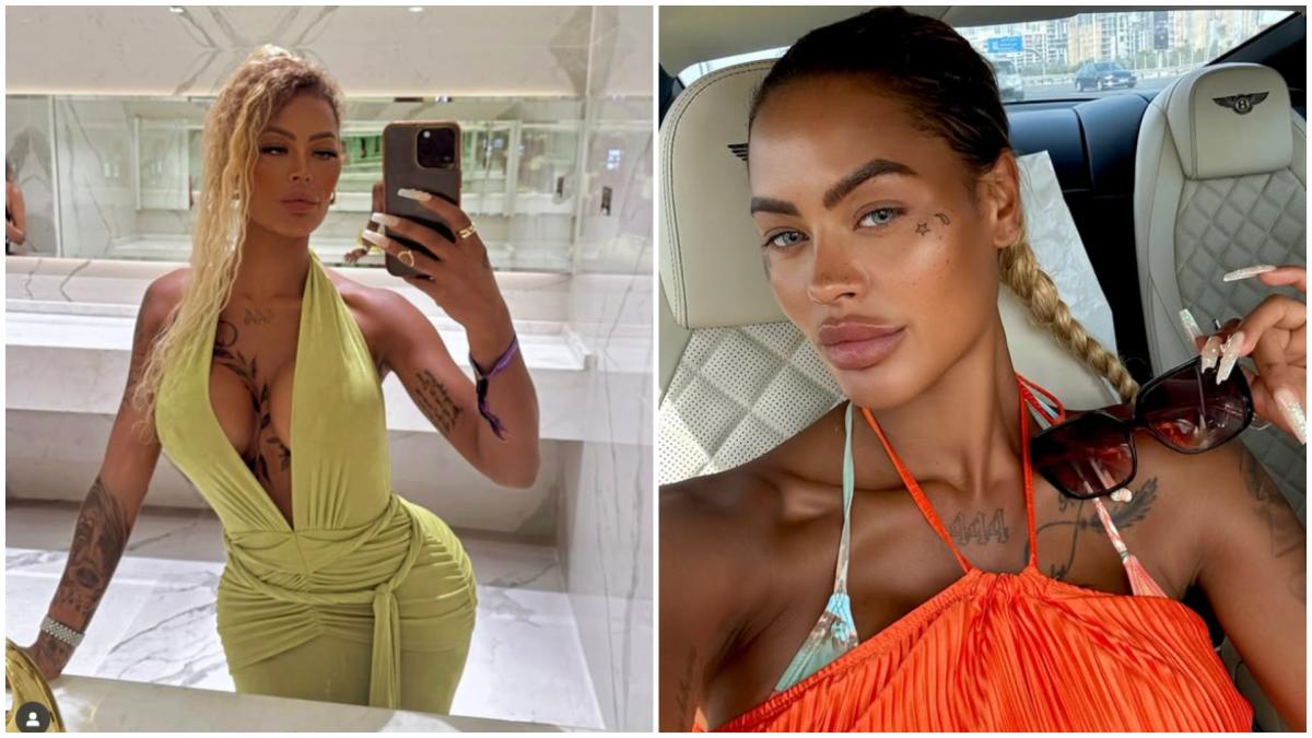 o femeie a povestit cum i au cazut implanturile la fesieri la sala de sport si cat a cheltuit pentru interventii de corectie