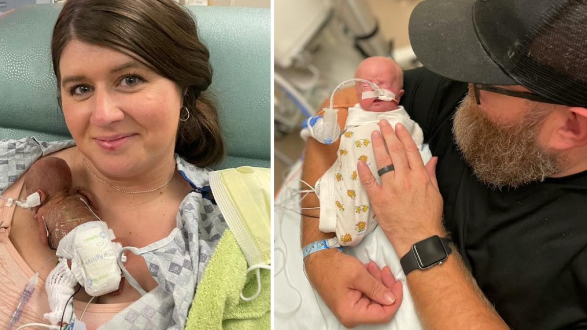 povestea emotionanta a celui mai prematur bebelus din lume s a nascut la doar 21 de saptamani in iowa