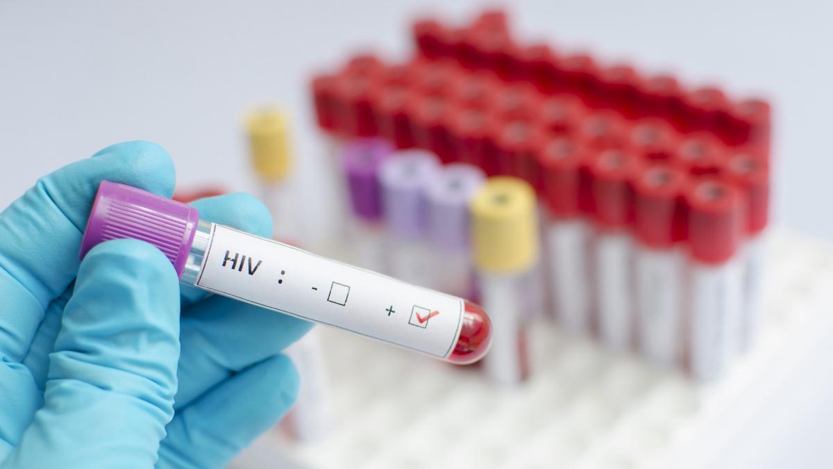 un nou tratament injectabil care ar putea preveni infectarea cu hiv este aproape de aprobare in ue