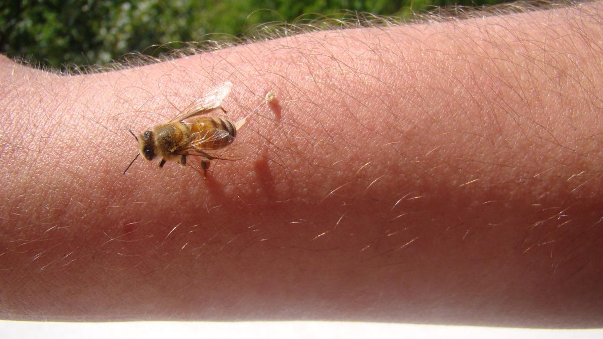 ce sa nu faci niciodata cand te inteapa o viespe sau albina de ce nu trebuie sa indepartezi acul cu penseta