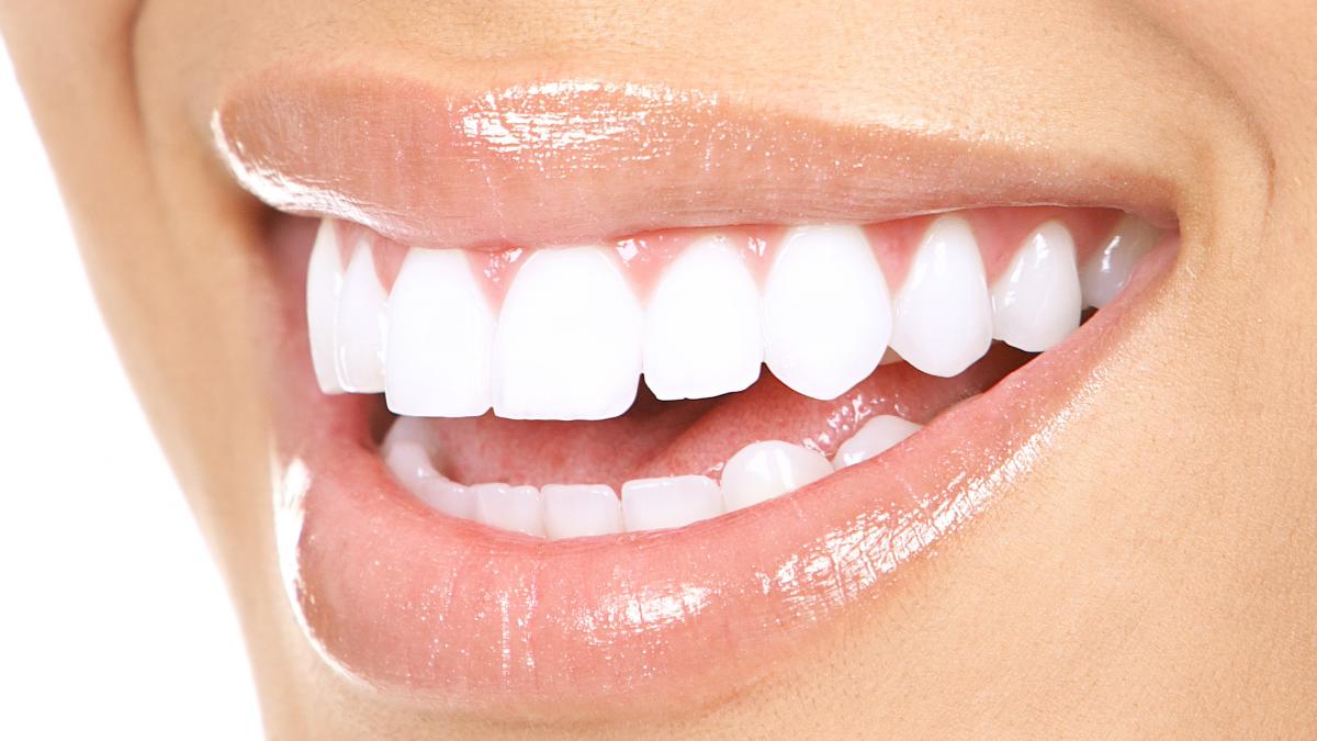 implantul dentar in 2025 tot ce trebuie sa stii despre costuri avantaje si siguranta