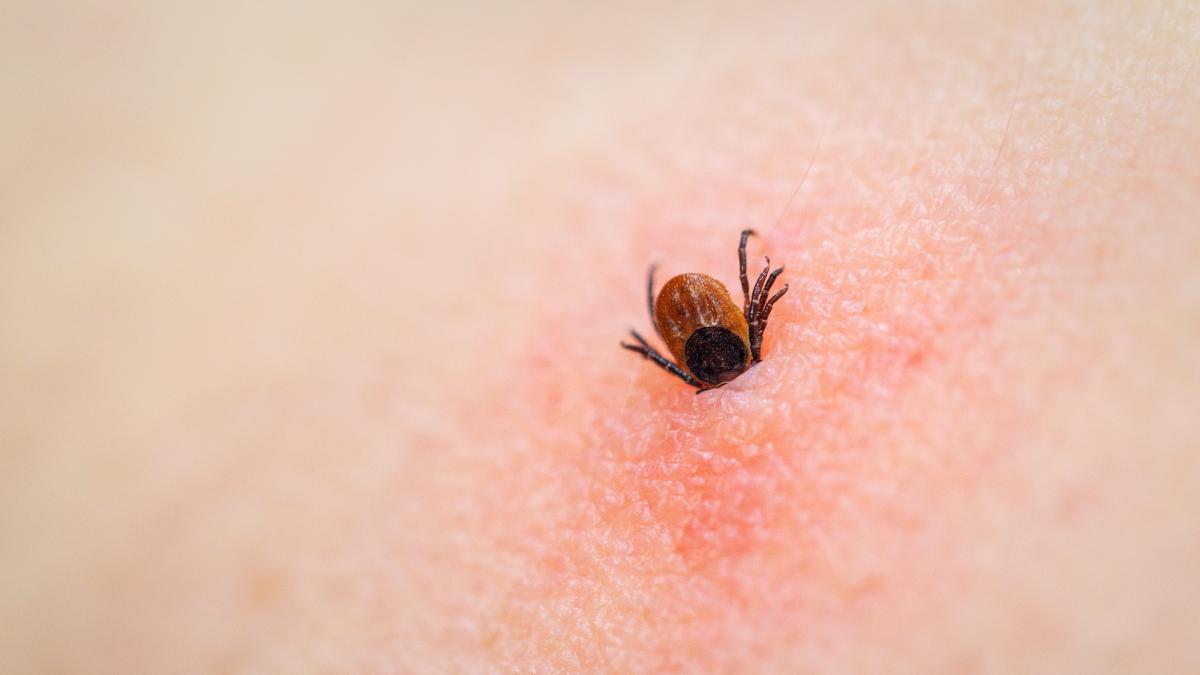 care sunt primele simptome ale bolii lyme la ce trebuie sa fii atent dupa ce ai fost muscat de capusa