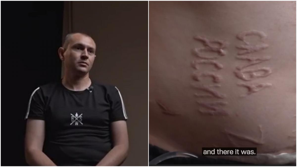 prizonierul ucrainean torturat si marcat cu glorie rusiei vrea sa se intoarce pe front dupa recuperare cu sete de razbunare