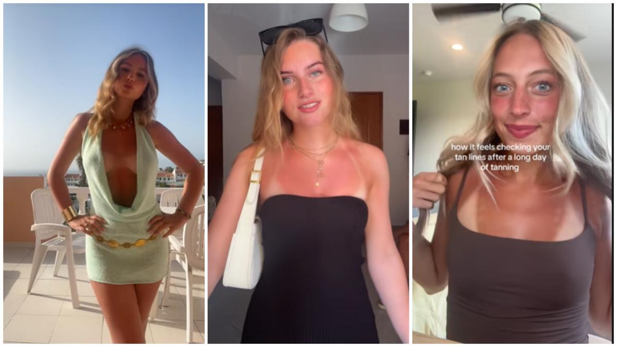 tiktokul are o noua obsesie arsurile solare franta vrea sa interzica trendul periculos dupa ce a blocat skinnytok