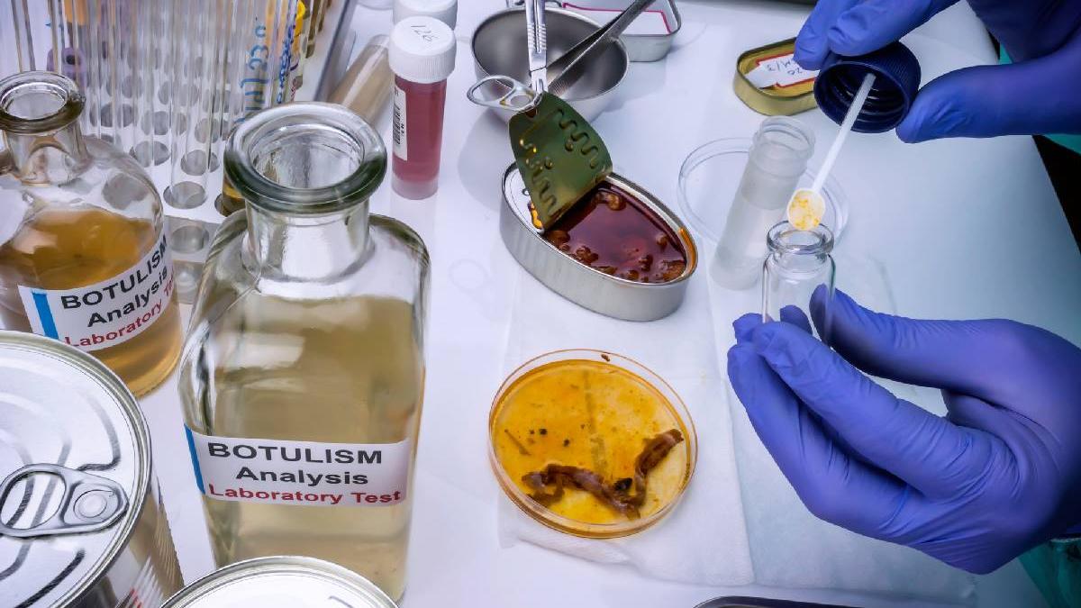 patru decese in italia din cauza botulismului mai multe persoane sunt inca internate in spital