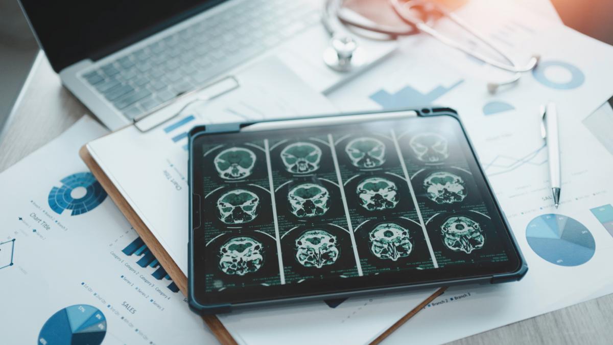 nu exista o cantitate sanatoasa de alcool cand vine vorba de dementa arata un studiu amplu orice bautura creste riscul de alzheimer