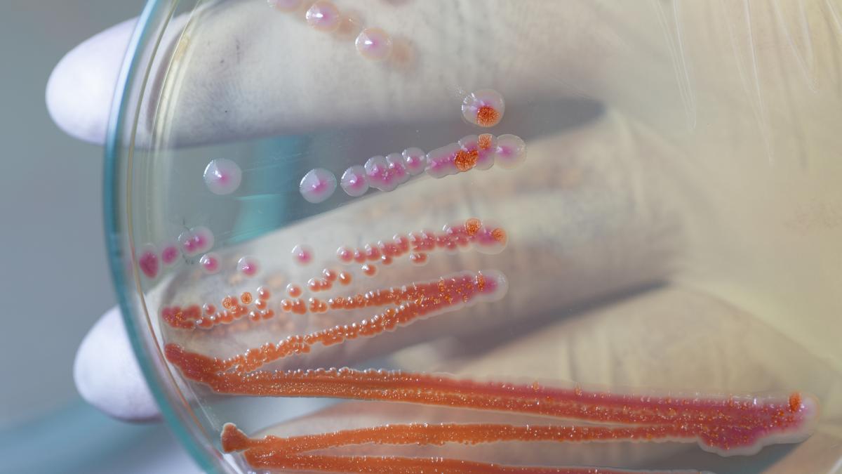 ce este serratia marcescens bacteria care a dus la moartea a sase copii in spitalul sf maria din iasi