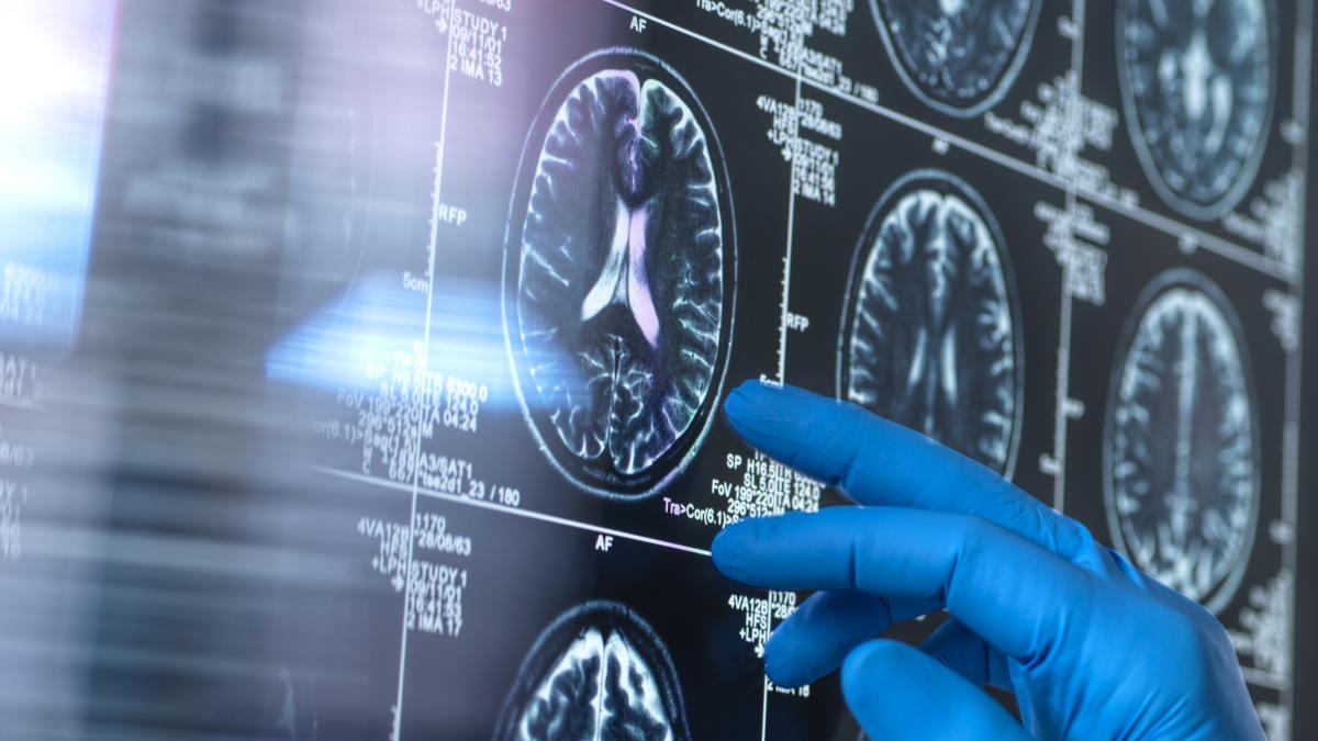 ce se intampla cu creierul copiilor din cauza inegalitatii sociale efectele sunt vizibile la rmn