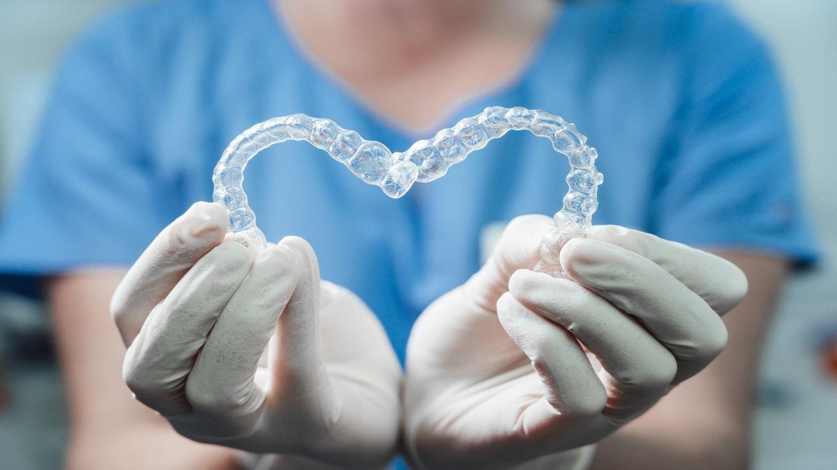 cat costa un aparat dentar preturi in functie de tipurile de aparat dentar