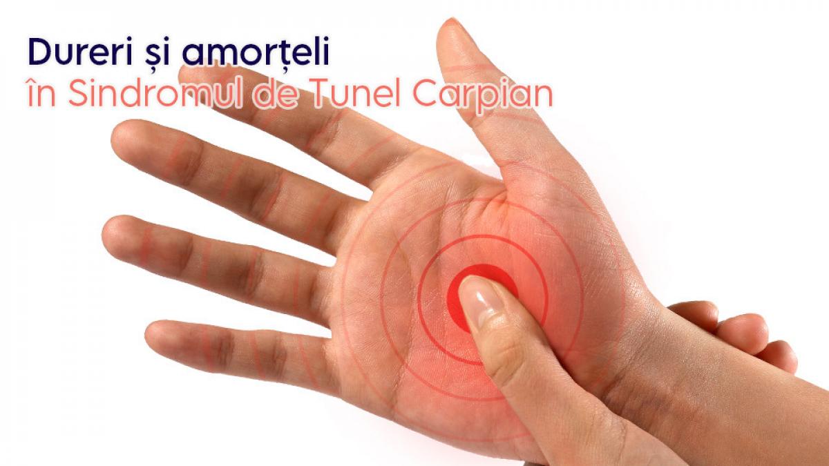 sindromul de tunel carpian cand mana devine semnalul unui stil de viata suprasolicitat