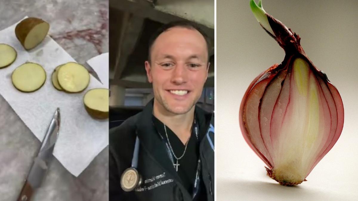 un trend de pe tiktok promovat de influenceri i a alarmat pe medici ce se intampla daca pui felii de cartofi cruzi in sosete