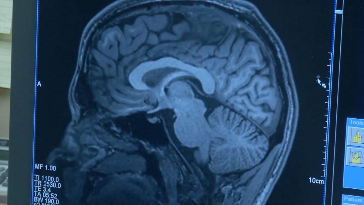 creierul uman este preconfigurat cu instructiuni pentru a intelege lumea dinainte sa avem experiente externe arata un nou studiu