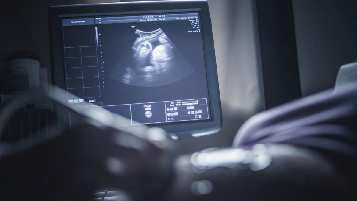 o femeie a ramas din nou insarcinata in timp ce era deja gravida a fost un soc