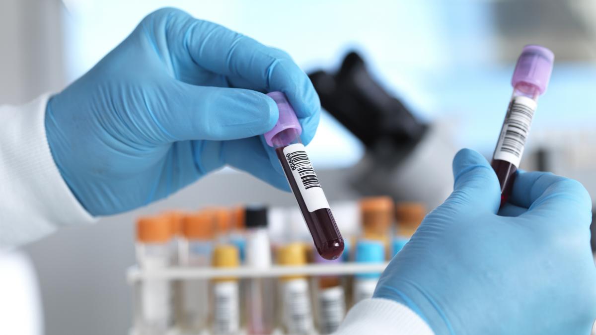 eprubete cu probe de sange