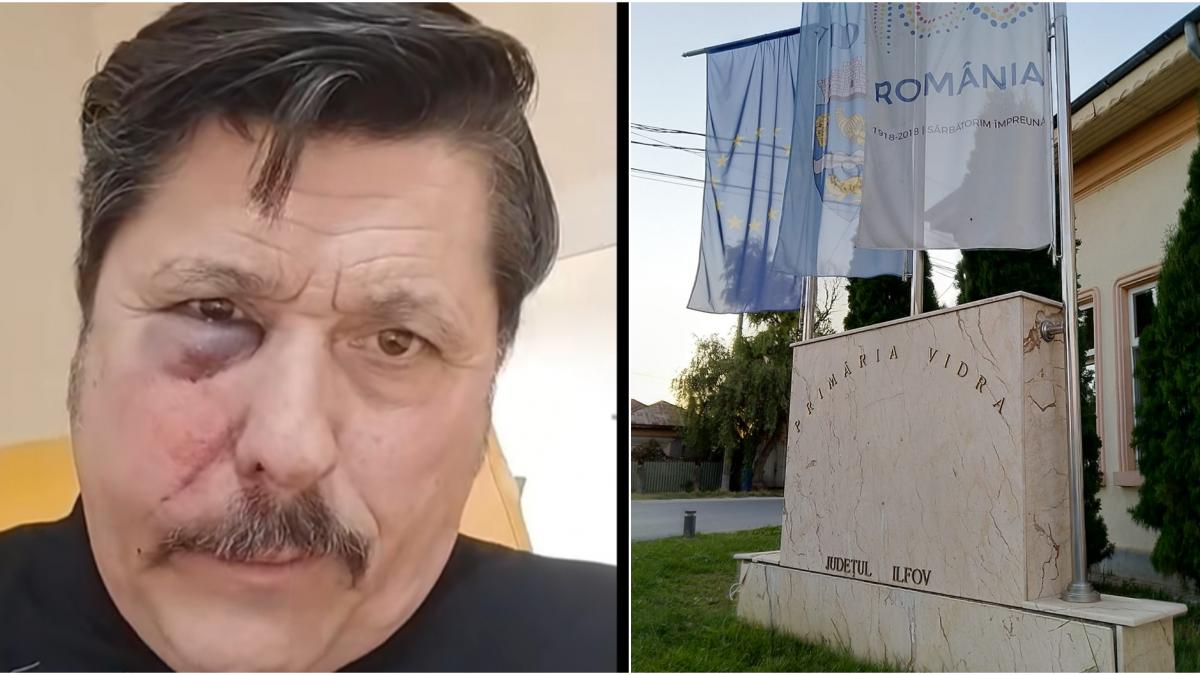 au dat cu ura sa ma omoare un consilier local aur a ajuns la spital cu fractura faciala dupa ce a fost batut in sedinta de consiliu