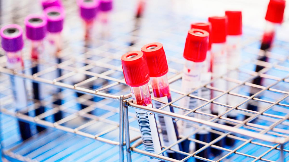 mai multe eprubete cu sange