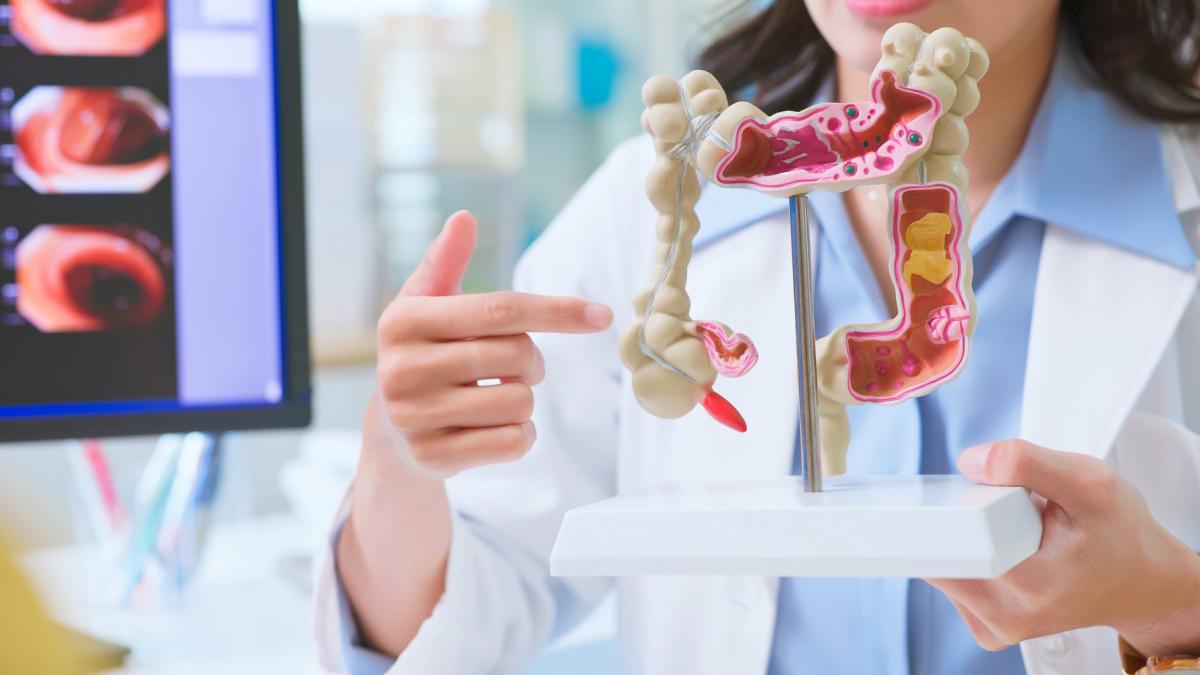 de ce tot mai multi tineri fac cancer de colon in unele tari a devenit principala cauza de deces oncologic la pacienti sub 50 de ani