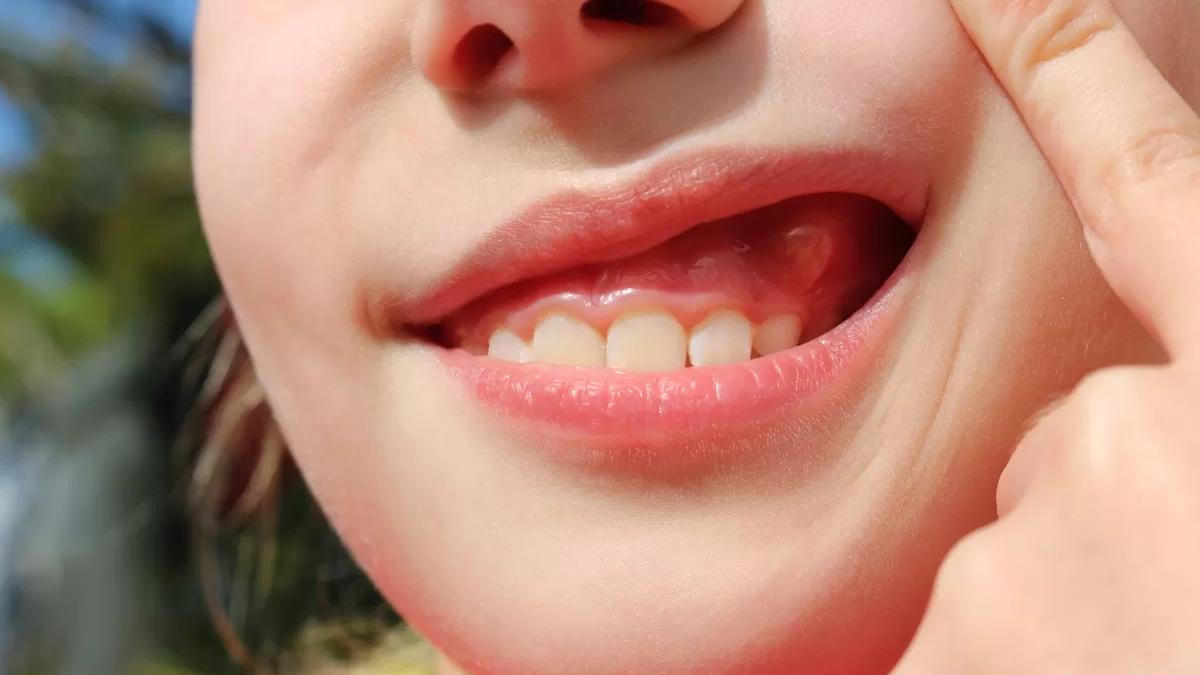 femeie care se tine de oraz pentru a i se vedea dintii