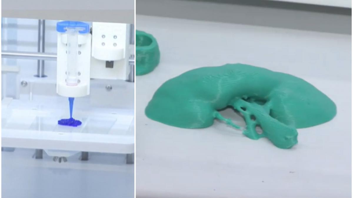 organe printate 3d si pansamente care vindeca pe loc cercetatorii romani revolutioneaza medicina se printeaza un rinichi chiar acum