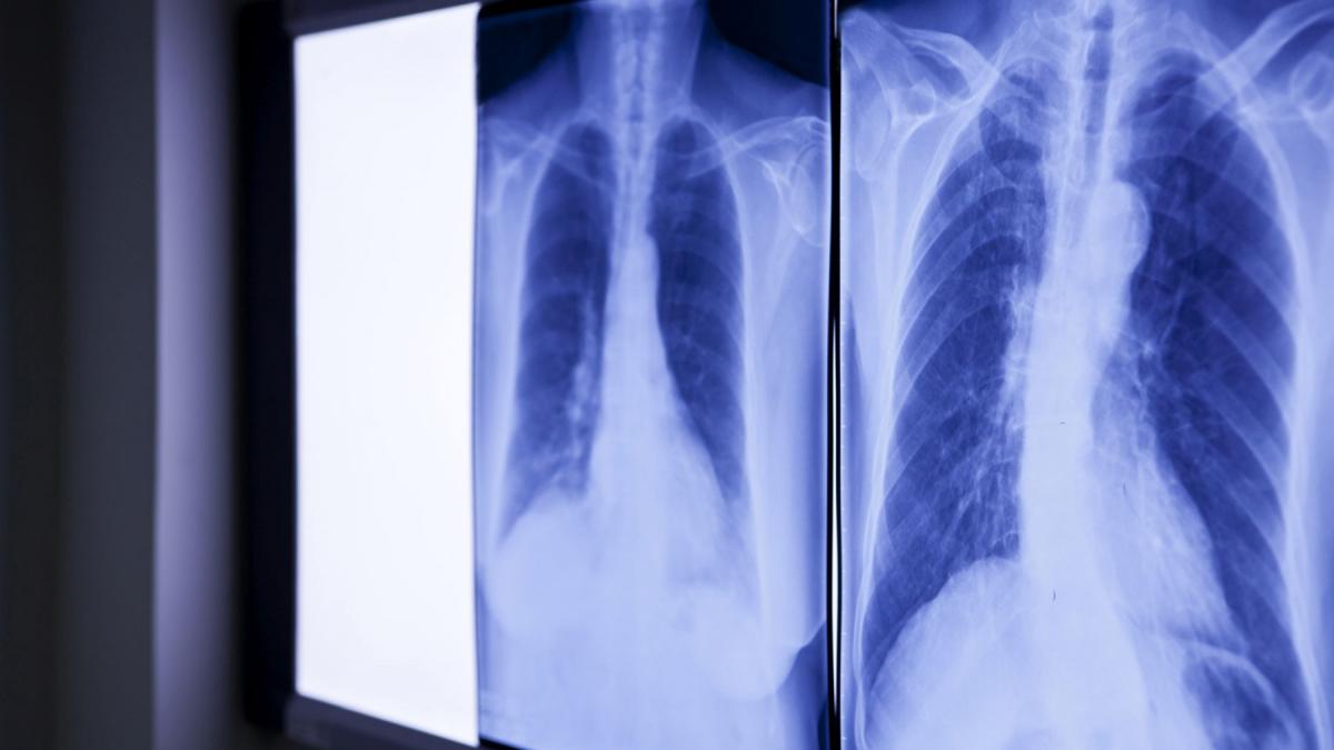 medicii socati de ce au gasit in abdomenul unui barbat care s a prezentat la urgente cu dureri severe e de peste 20 de ani acolo