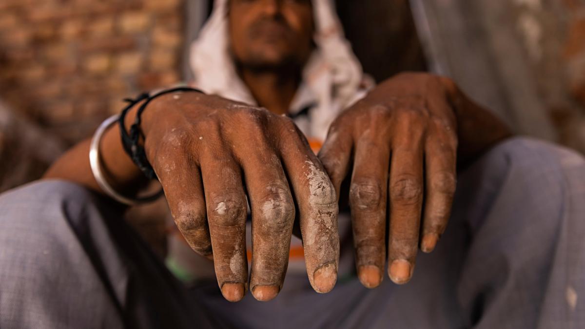 aparitie socanta intr o banca un indian a adus la ghiseu scheletul surorii sale ca dovada a decesului totul a fost filmat