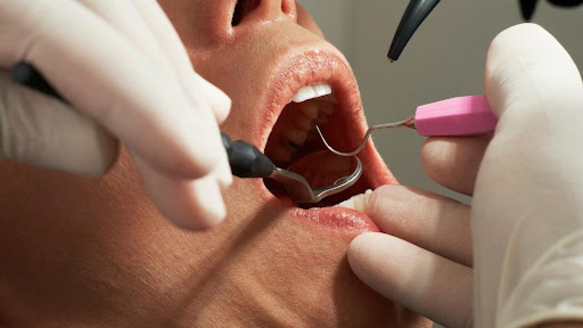 recuperare lenta dupa extractii dentare si implanturi cum accelereaza oxigenul hiperbaric vindecarea osoasa