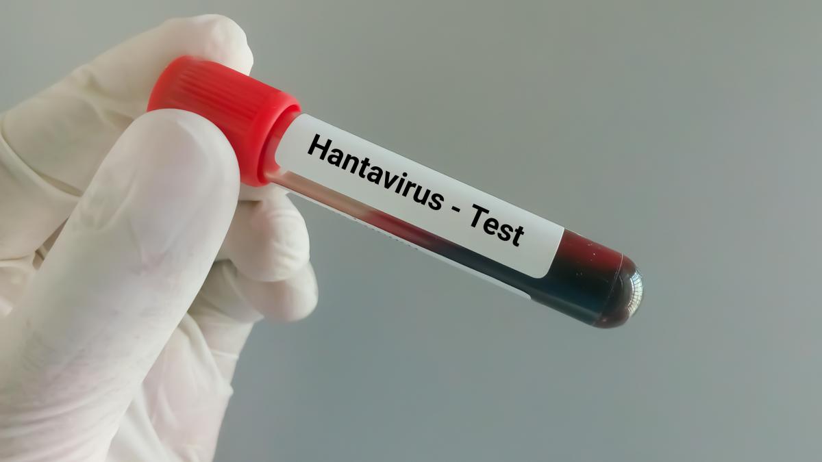 ucraina inregistreaza zeci de cazuri de hantavirus in fiecare an a anuntat centrul de sanatate publica ucrainean