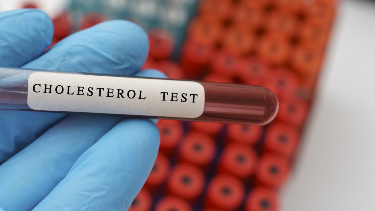 test de sange colesterol