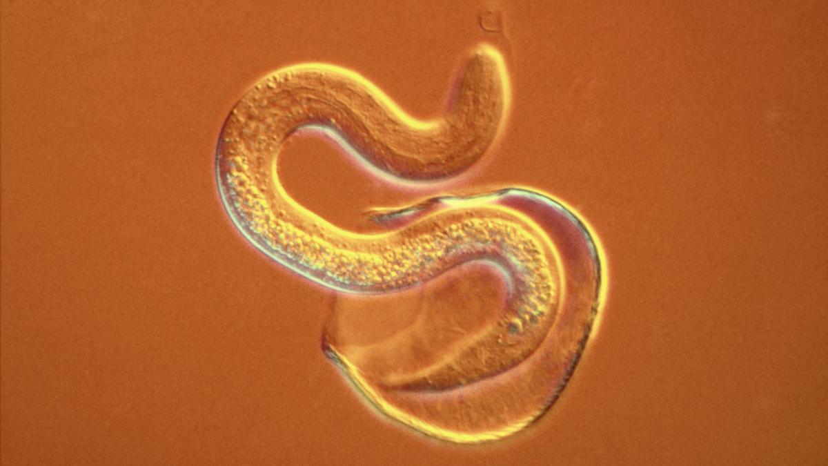 parazit intestinal
