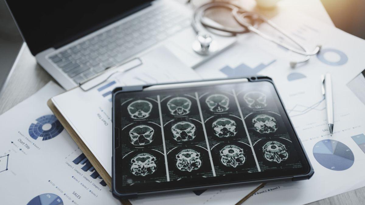 radiografii craniene instrumentar medical
