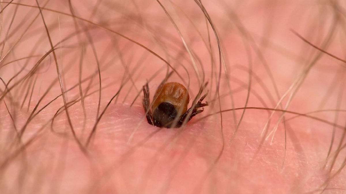 capusa infipta in piele