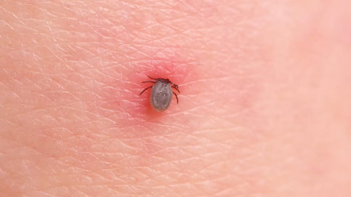 capusa infipta in piele cu iritatie in jur