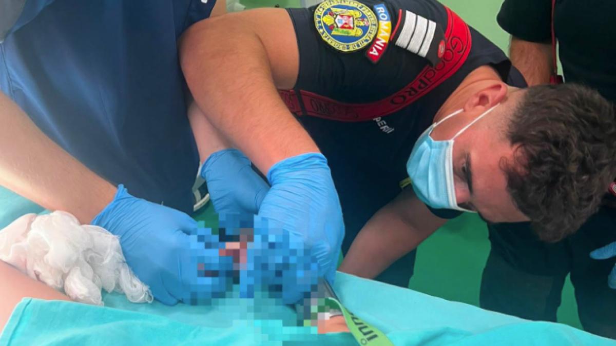 un copil de 2 ani din reghin a ramas cu mana prinsa in masina de tocat pompierii au intervenit in sala de operatie ajutati de medici