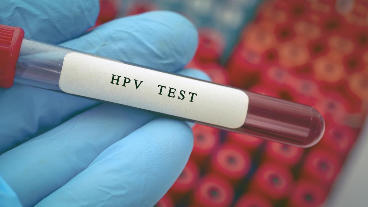 care sunt semnele infectiei cu hpv si barbatii pot dezvolta leziuni precanceroase