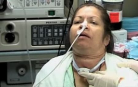 O femeie din SUA şi-a recăpătat vocea, în urma unui transplant de laringe