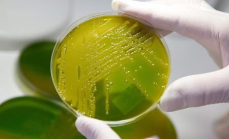 Bacteria E.coli a ajuns în SUA. Peste 1.500 de oameni au fost îmbolnăviţi în Germania