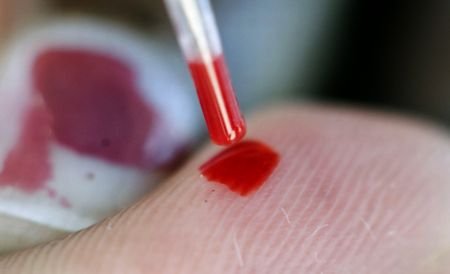 O simplă analiză de sânge ar putea revoluţiona tratamentul cancerului