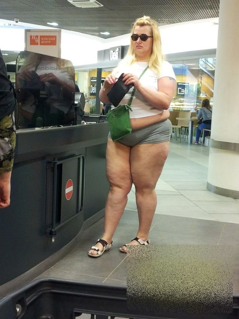 Ноги у толстых людей. Жирные девушки в шортах.