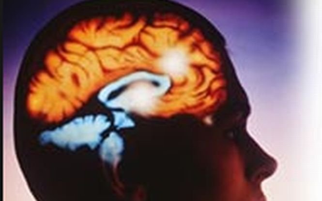 Studiu: Migrenele pot modifica în mod permanent structurile creierului