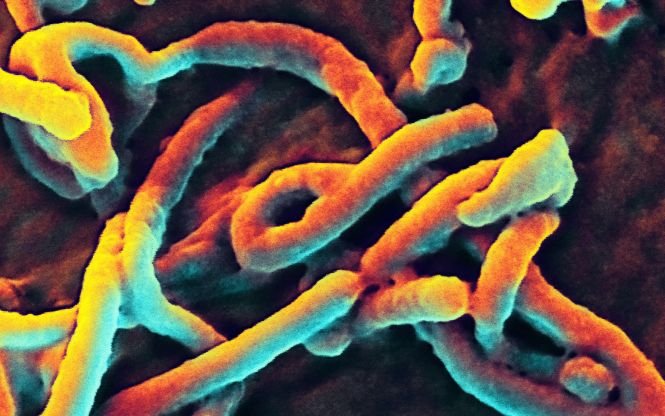 Obama: Eforturile pentru contracararea epidemiei de Ebola sunt prea lente