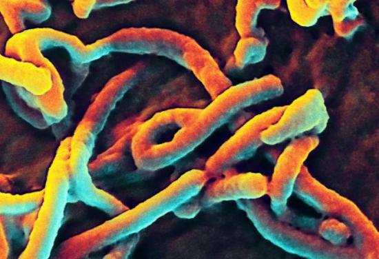 Experţii militari britanici se tem că virusul Ebola ar putea fi folosit ca ARMĂ