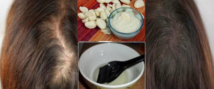 7 Măști de păr cu ulei de ricin pe care le poți face acasă