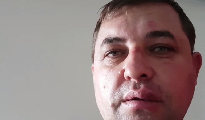 De ce a fost bătut un viceprimar din România