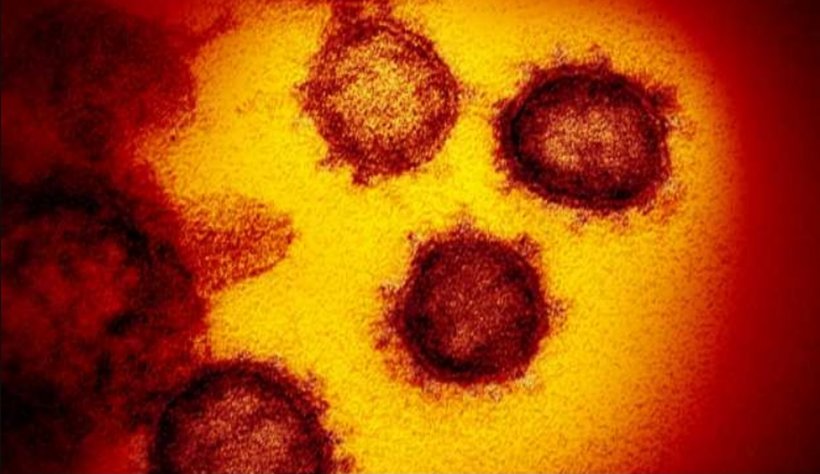 Cum arată coronavirusul văzut la microscop. Microbiologi din întreaga lume încearcă să găsească un vaccin 